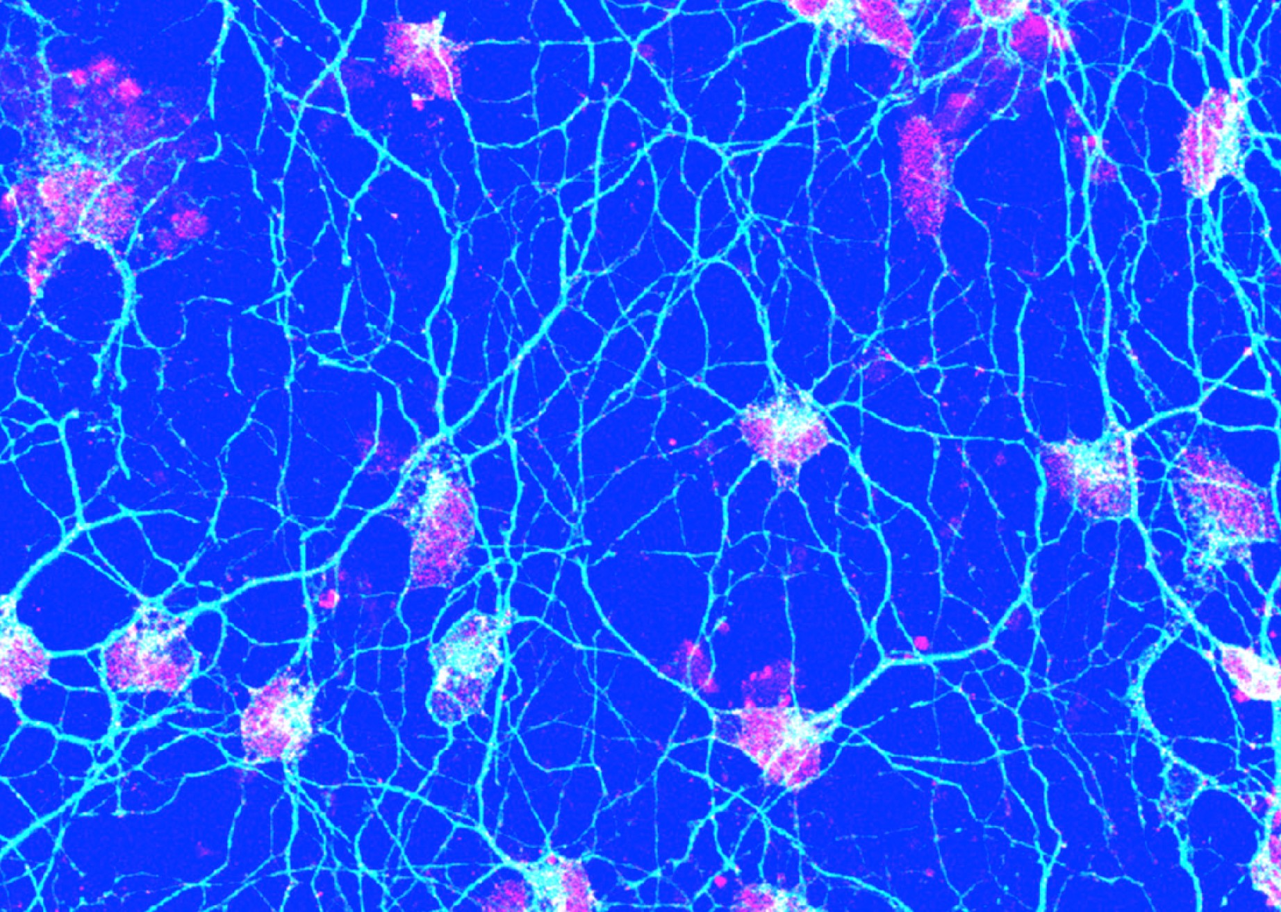Experimental tests of consciousness theories