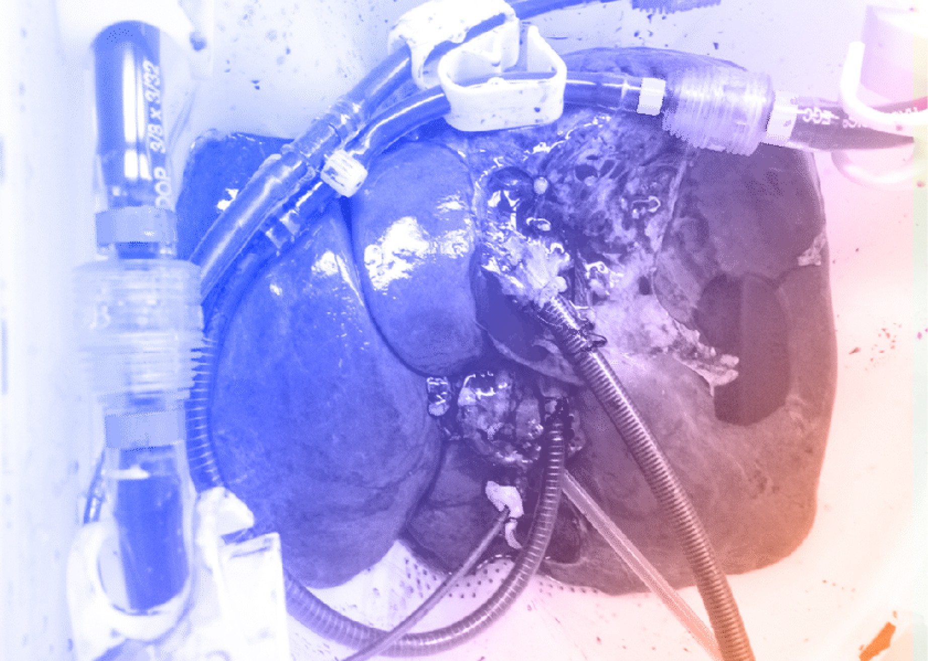 Biohybrid neural interfaces